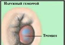 У ДАІ зовнішню рекламу назвали однією з головних причин ДТП